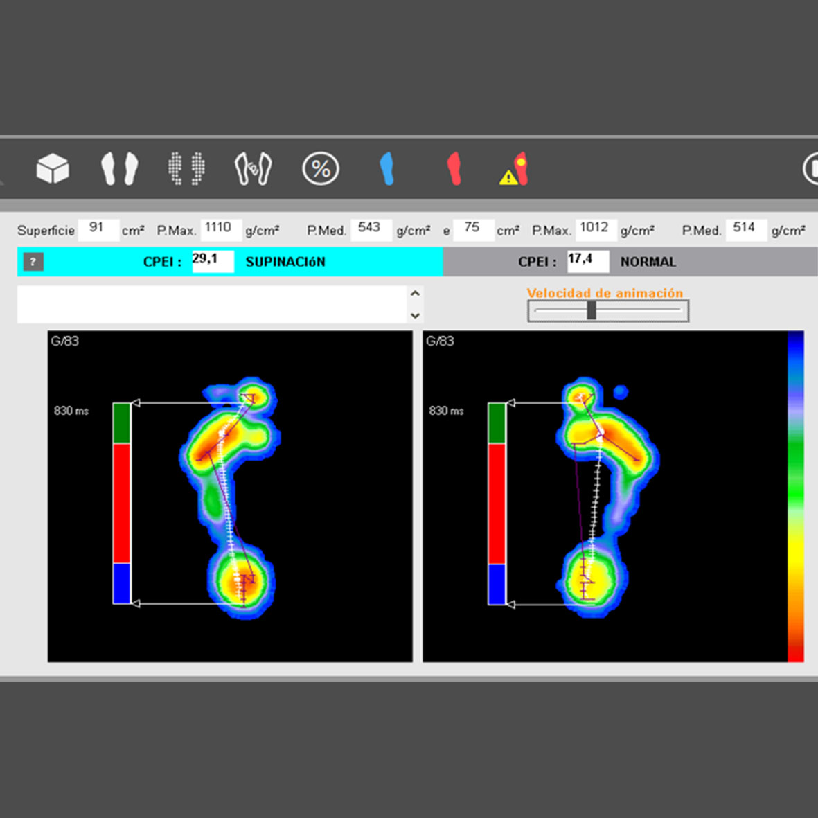 Estudis Biomecànics