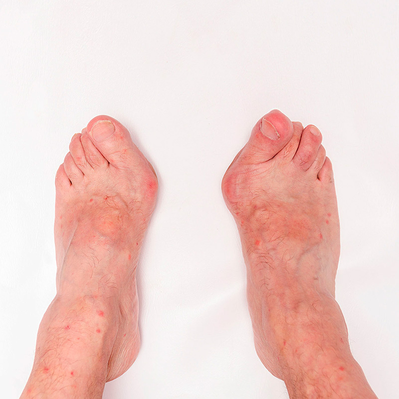 Podologia Geriàtrica